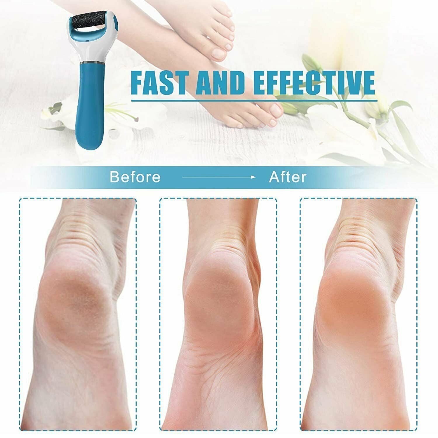 0229 Electronic Dry Foot File, Callous Remover for Feet, Electric Foot with Roller Hard and Dead Skin- Regular Coarse, Baby smooth feet in minutes. For in home padicure foot care, Battery Powered & USB (Battry not included)